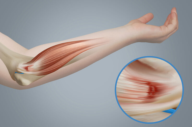 forearm meaning in hindi - Hình 2
