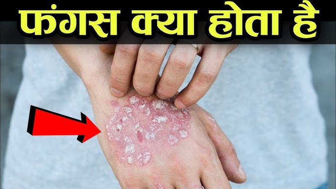 फंगी (Fungi) का हिंदी में अर्थ और अनुवाद