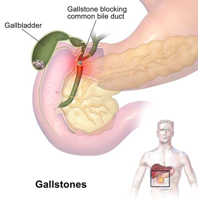 पित्ताशय (Gall Bladder) का हिंदी में अर्थ: सरल परिभाषा (Pittashay (Gall Bladder) ka Hindi mein Arth: Saral Paribhasha)