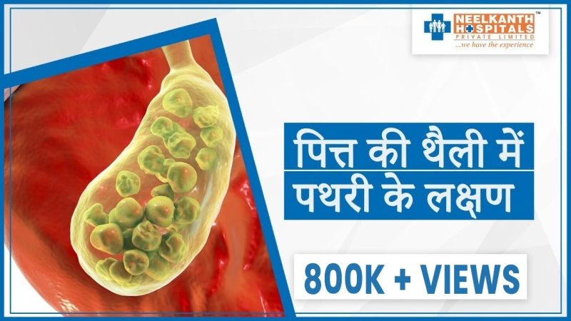 पित्ताशय की थैली (Gall Bladder) क्या है? शरीर में इसकी भूमिका (Pittashay ki Thaili (Gall Bladder) Kya Hai? Shareer Mein Iski Bhumika)