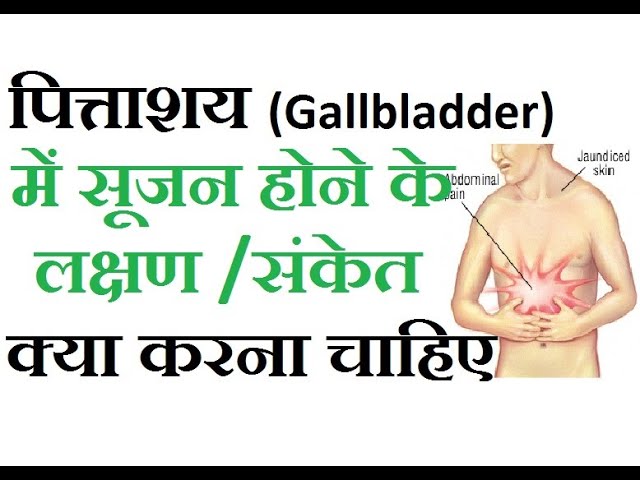 पित्ताशय की थैली में सूजन (पित्ताशयशोथ): कारण, लक्षण और उपचार (Gallbladder mein sujan (Pittashayashoth): Karan, lakshan aur upchar)