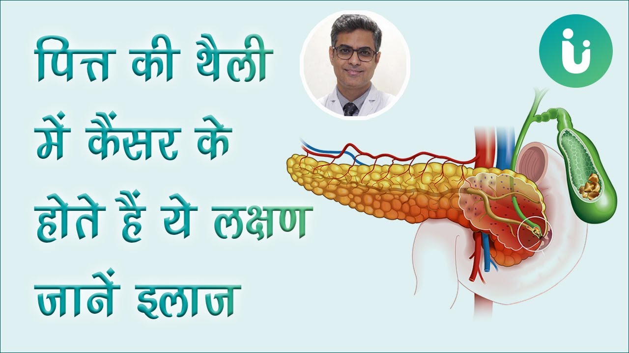 पित्ताशय की थैली के कैंसर: लक्षण, निदान और उपचार (Gallbladder ke cancer: Lakshan, nidan aur upchar)