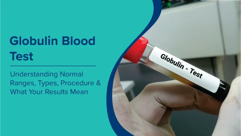 globulin meaning in hindi - Hình 3