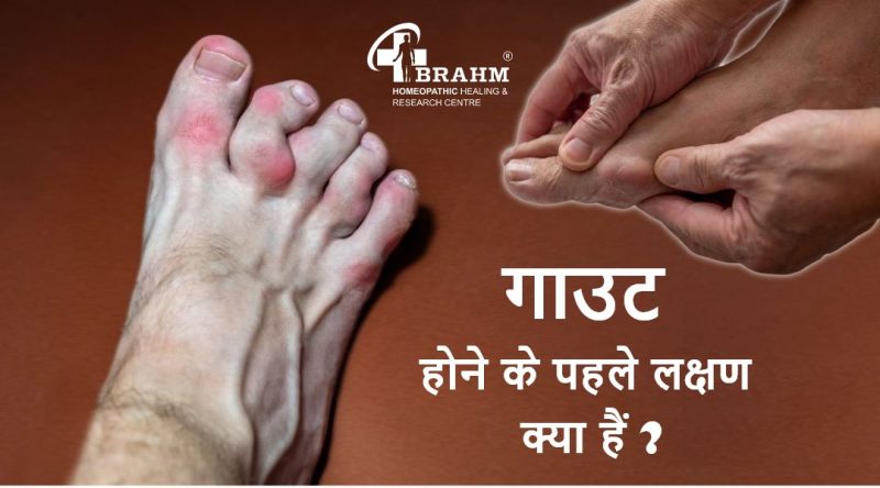 गाउट क्या है? (Gout Kya Hai?)