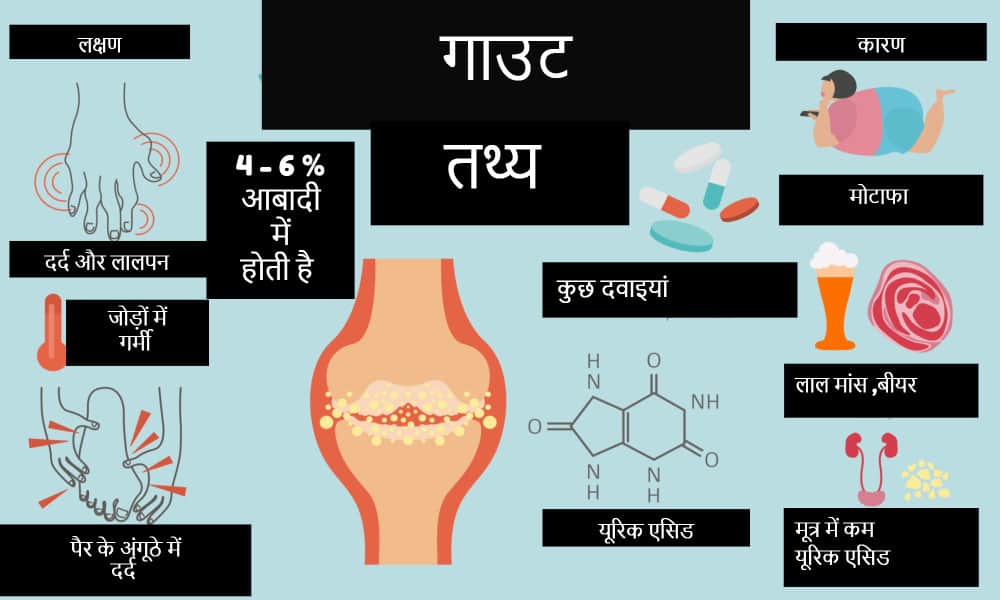 गाउट के कारण, लक्षण और निदान (Gout Ke Karan, Lakshan Aur Nidan)