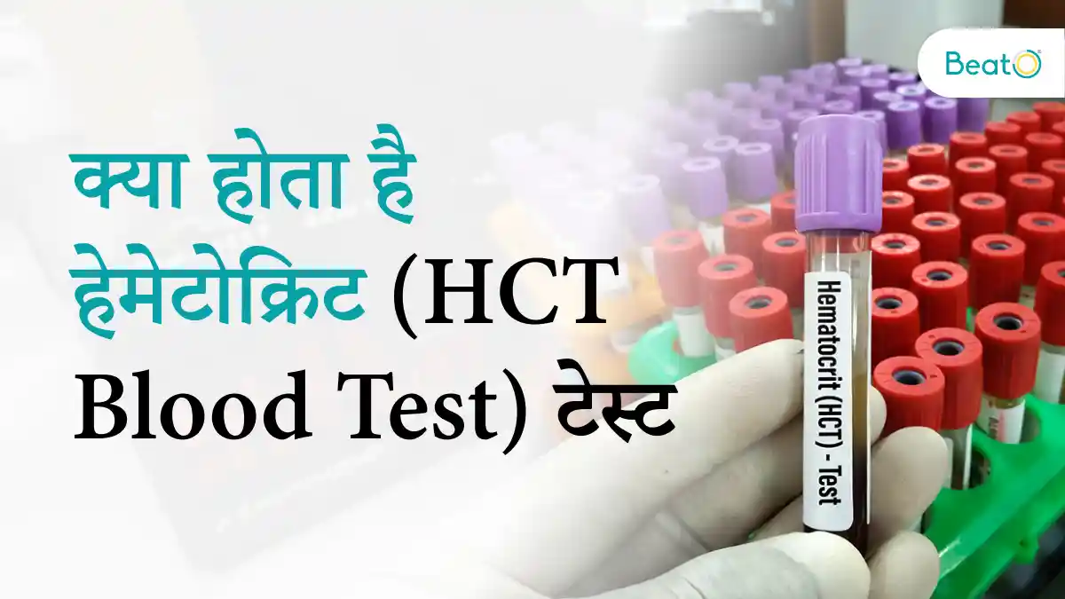 हीमेटोक्रिट टेस्ट क्यों किया जाता है?  Hematocrit Test Kyon Kiya Jata Hai?