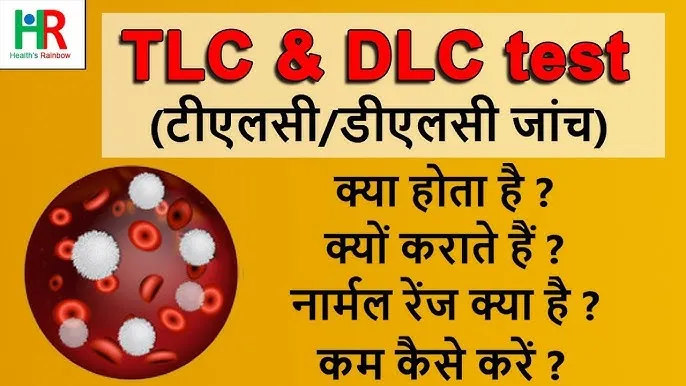Dlc Meaning In Hindi: डिफरेंशियल ल्यूकोसाइट काउंट टेस्ट की संपूर्ण जानकारी