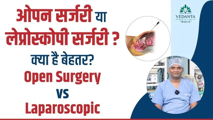 लैप्रोस्कोपिक सर्जरी: Laparoscopic In Hindi Meaning, प्रक्रिया, फायदे और जोखिम की विस्तृत जानकारी