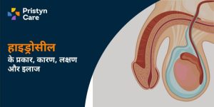 hydrocele meaning in hindi 1