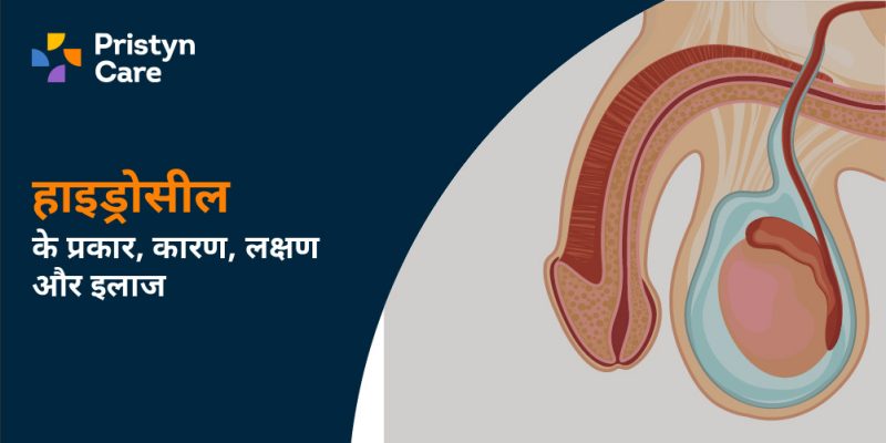 हाइड्रोसील का मतलब हिंदी में: परिभाषा और बुनियादी जानकारी