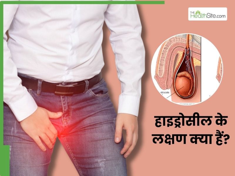 हाइड्रोसील के कारण: हिंदी में पूरी जानकारी