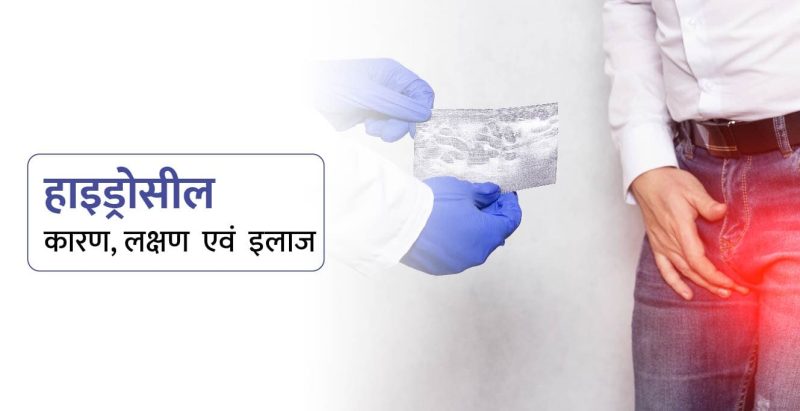 हाइड्रोसील के लक्षण: हिंदी में पहचानें और समझें