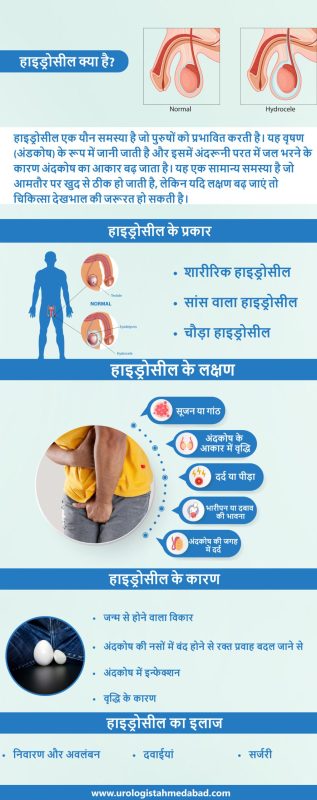 हाइड्रोसील का निदान: हिंदी में परीक्षण और प्रक्रियाएं