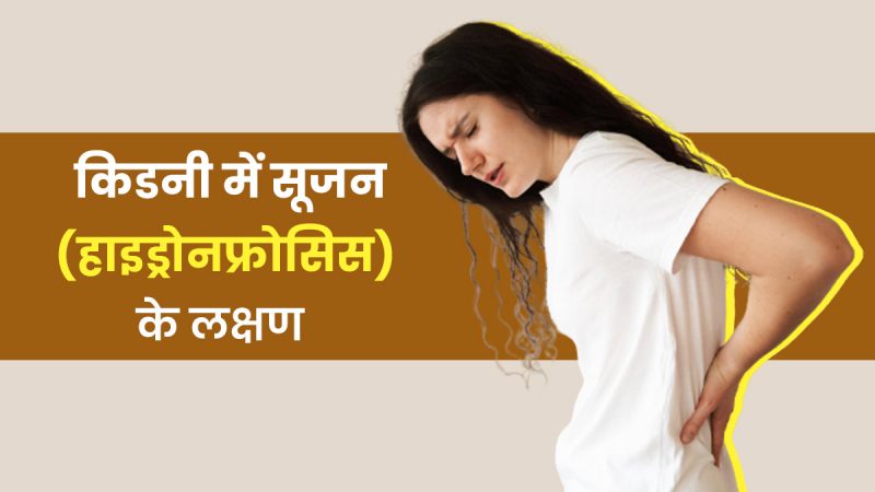 Hydronephrosis का निदान: हिंदी में तरीके