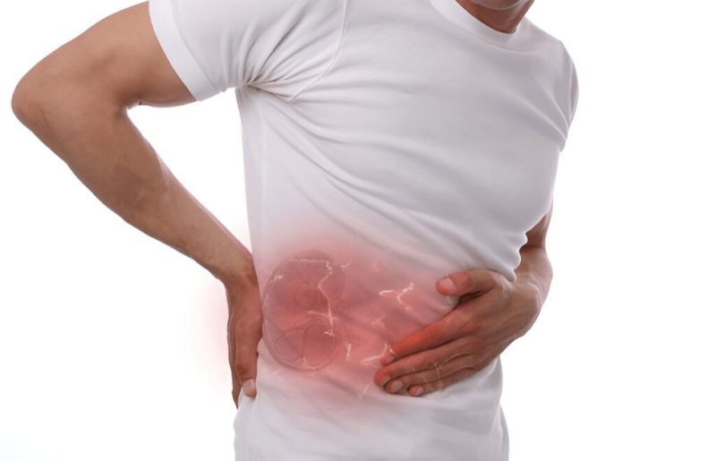 Hydronephrosis की जटिलताएँ: हिंदी में स्पष्टीकरण