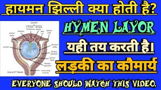 Hymen का अर्थ: हिंदी में योनिच्छद और कौमार्य झिल्ली