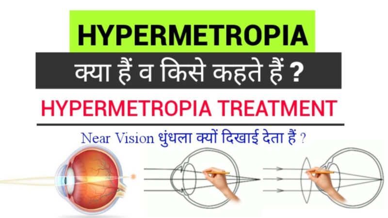 hypermetropia meaning in hindi - Hình 2