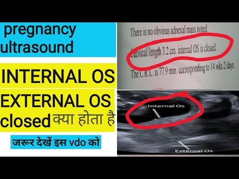 internal os is closed meaning in hindi 4