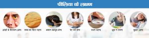 jaundice meaning in hindi 3