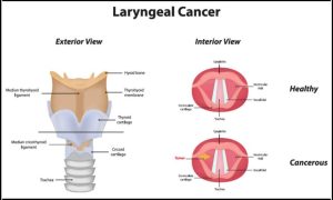 larynx meaning in hindi 3