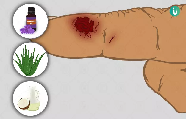 lesion meaning in hindi 5