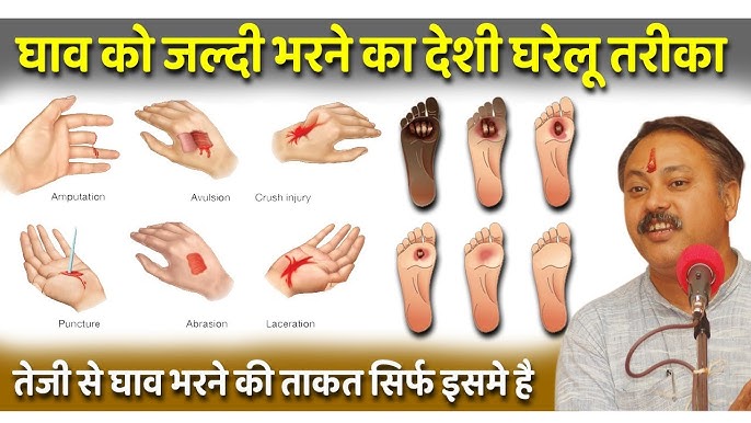 lesion meaning in hindi 6
