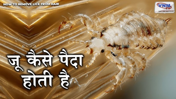 lice meaning in hindi 1