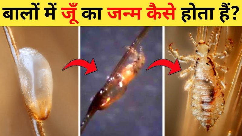 जूँ (Lice) क्या हैं? प्रकार, जीवन चक्र और पहचान