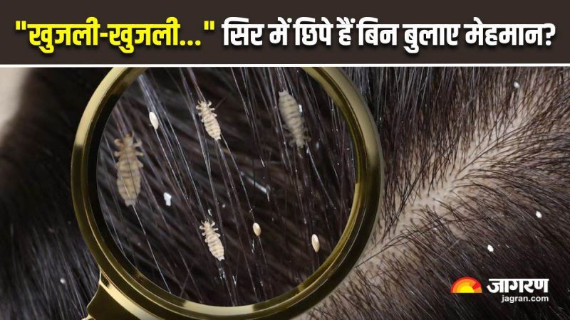 जूँ (Lice) के संक्रमण के कारण और खतरे के कारक