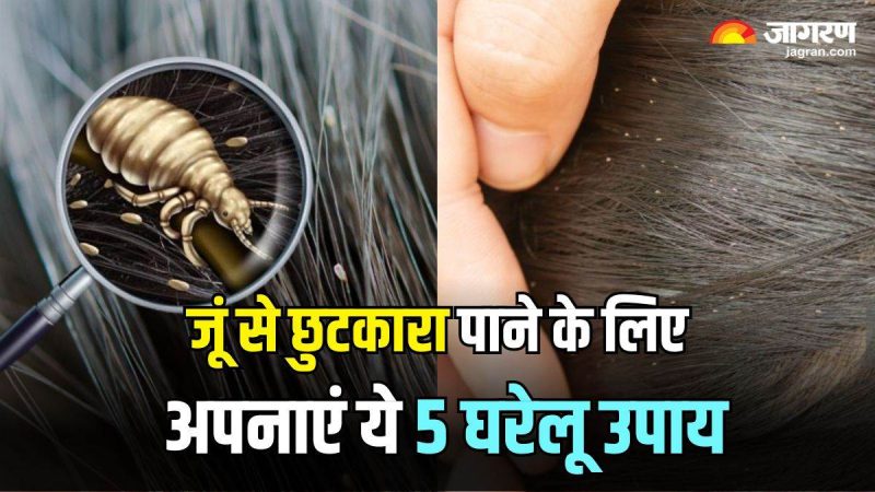 जूँ (Lice) के संक्रमण का प्रभावी ढंग से इलाज कैसे करें: घरेलू उपचार और चिकित्सा विकल्प