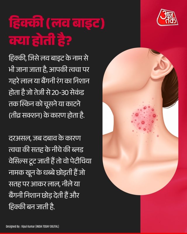 लव बाइट का हिंदी में अर्थ क्या है? (Love Bite ka Hindi mein arth kya hai?)