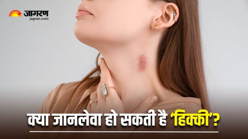 लव बाइट के लक्षण और पहचान (Love Bite ke lakshan aur pehchaan)
