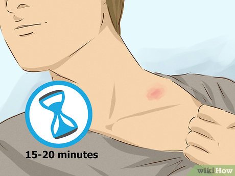 लव बाइट को मेकअप से कैसे छुपाएं? (Love Bite ko makeup se kaise chhupaen?)