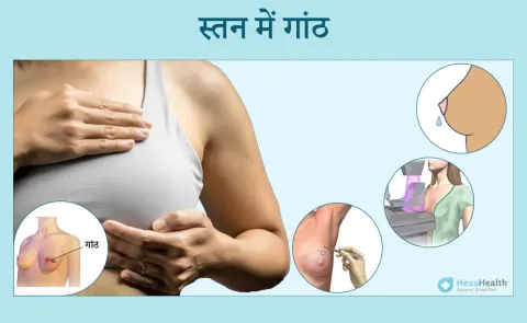 lump meaning in hindi 2
