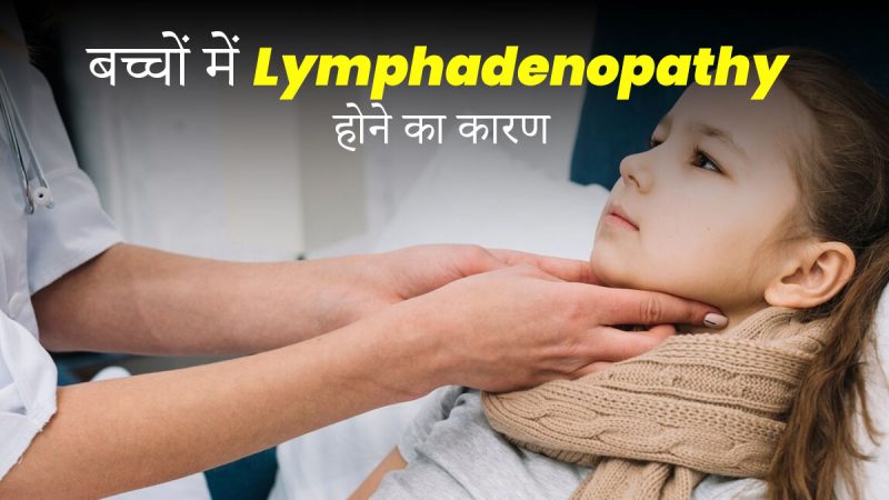 लिम्फैडेनोपैथी का हिंदी में अर्थ: परिभाषा और मूल बातें (Lymphadenopathy Ka Hindi Mein Arth: Paribhasha Aur Mool Baten)