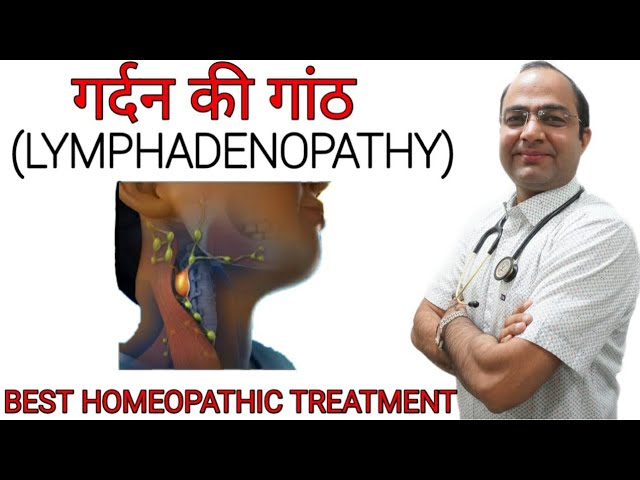 लिम्फैडेनोपैथी का उपचार: विकल्पों की पूरी जानकारी (Lymphadenopathy Ka Upchar: Vikalpon Ki Puri Jankari)