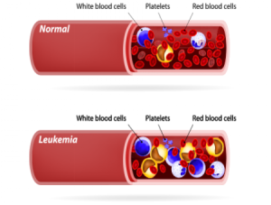 lymphocytes meaning in hindi 3