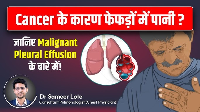 घातकता का अर्थ क्या है? (Understanding the Meaning of Malignancy)