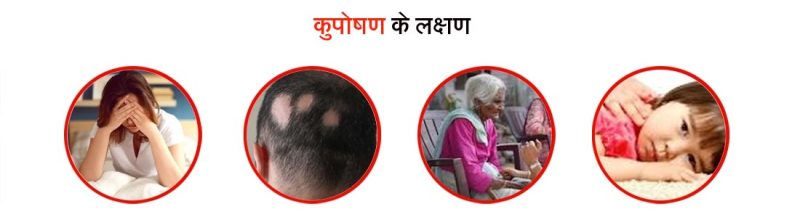 वयस्कों में कुपोषण: जोखिम कारक, लक्षण और जटिलताएं (Vyaskon mein kuposhan: Jokhim karak, lakshan aur jatiltayen)