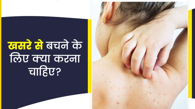 खसरा का इलाज कैसे किया जाता है? (खसरा का उपचार: चिकित्सा हस्तक्षेप)