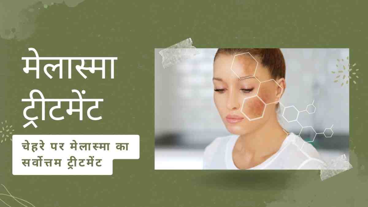 मेलास्मा से बचाव: हिंदी में सुझाव और सावधानियां (Melasma se bachav: Hindi mein sujhav aur savdhaniyan)