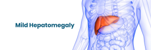 mild hepatomegaly meaning in hindi 5