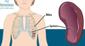 mild splenomegaly meaning in hindi 3