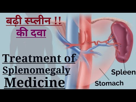 माइल्ड स्प्लेनोमेगाली का निदान (Diagnosis of Mild Splenomegaly)