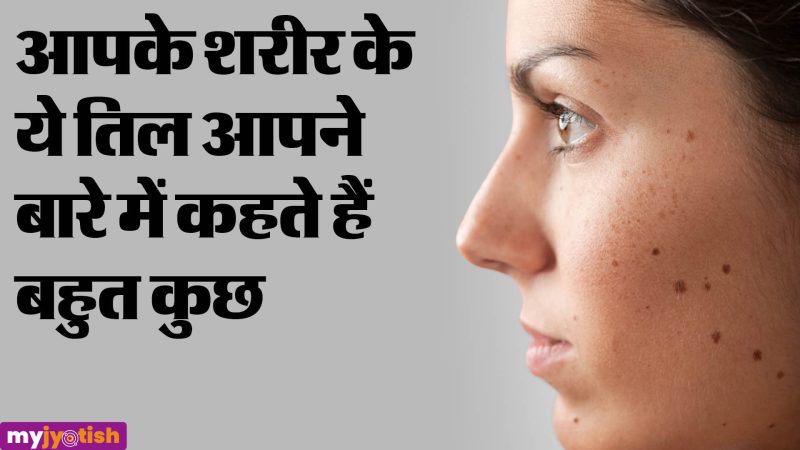शरीर पर तिलों का क्या मतलब होता है: विभिन्न स्थानों के अनुसार (What do moles on the body mean: According to different locations)