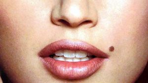 mole meaning in hindi 3