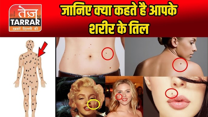 स्त्री और पुरुष के शरीर पर तिलों का फल: विस्तृत तुलना (Results of moles on the body of women and men: Detailed comparison)