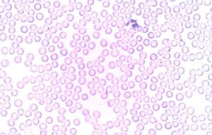 neutrophils meaning in hindi 3