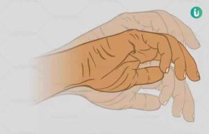 numbness meaning in hindi 3