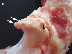 osteophytes meaning in hindi